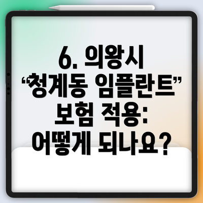 6. 의왕시 청계동 임플란트 보험 적용: 어떻게 되나요?